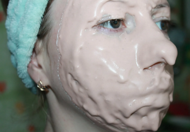 Альгинатные маски с гиалуроновой кислотой — что они дают нашей коже?